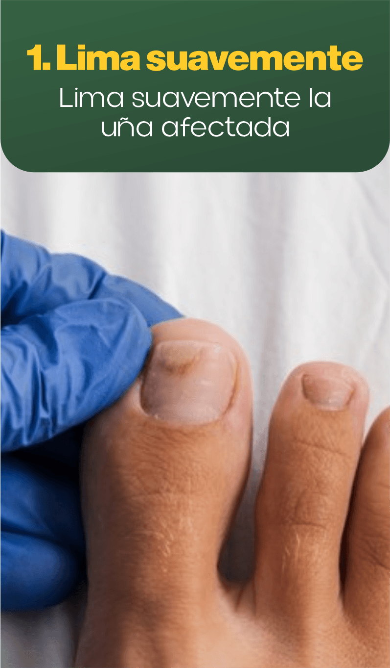 1. Lima suavemente